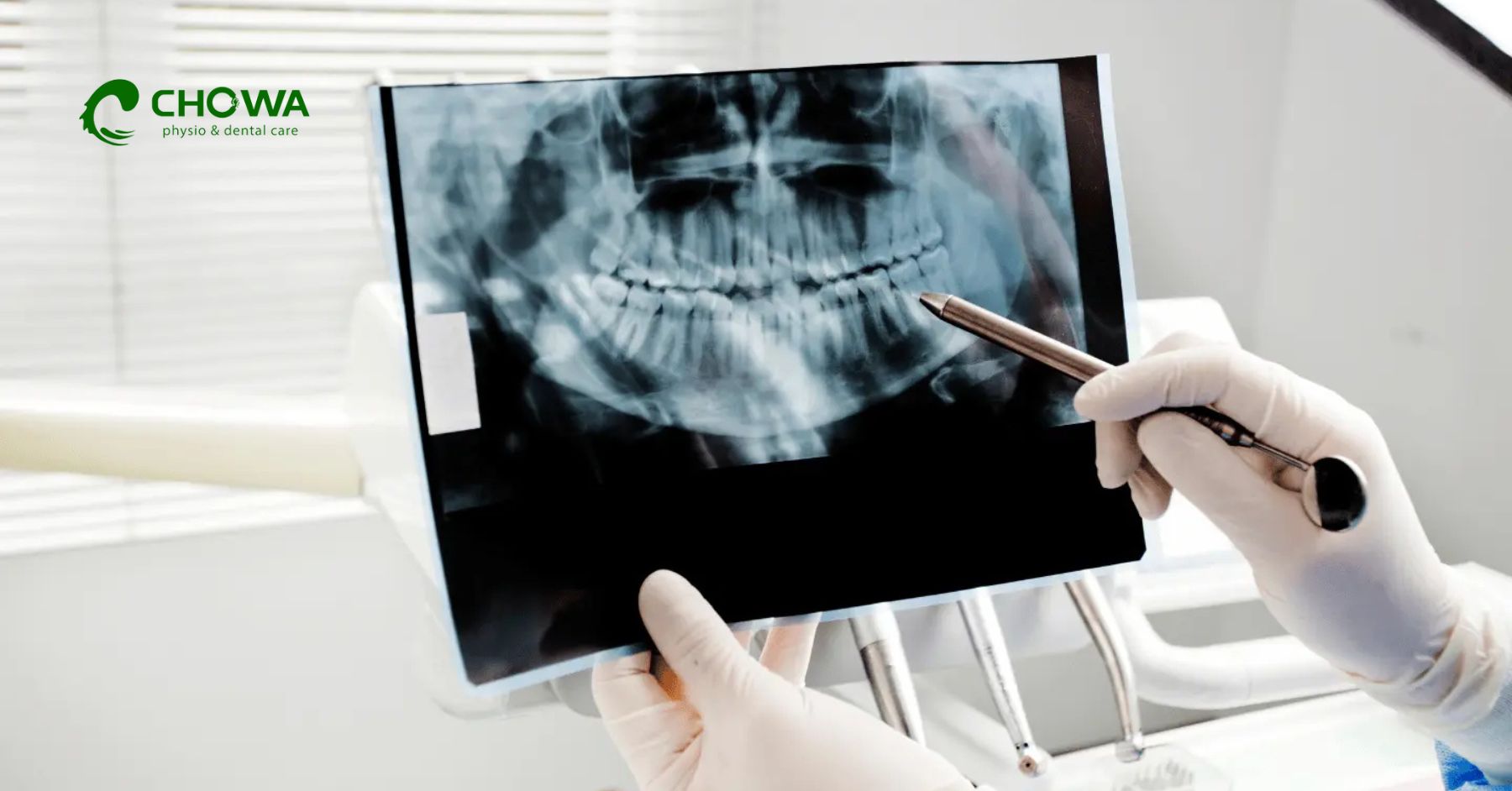 What happens during a dental X-ray showing full jaw scan and teeth structure for diagnosis