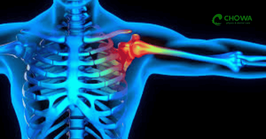 Shoulder joint pain scan for frozen shoulder physiotherapy in Gulshan evaluation