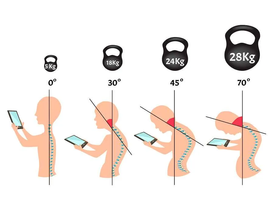 Phone posture angle chart for text neck treatment in Gulshan